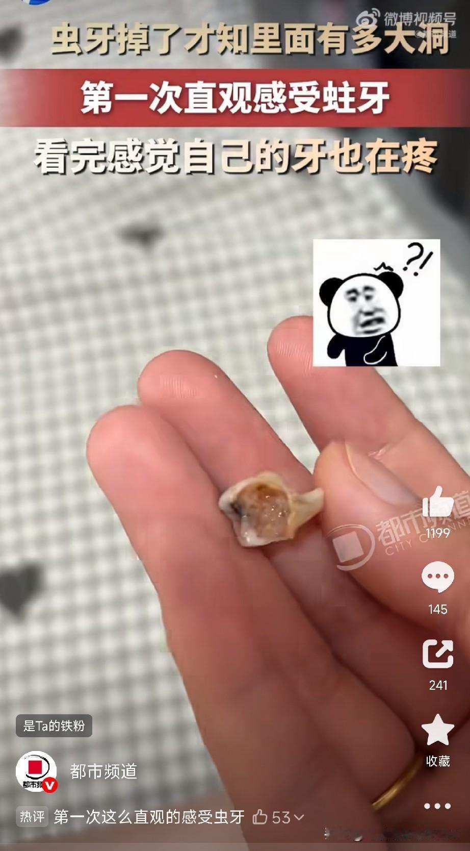 儿童龋齿一定要早发现，早治疗

河北一位宝妈晒出9岁儿子脱落的蛀牙，那颗牙简直触