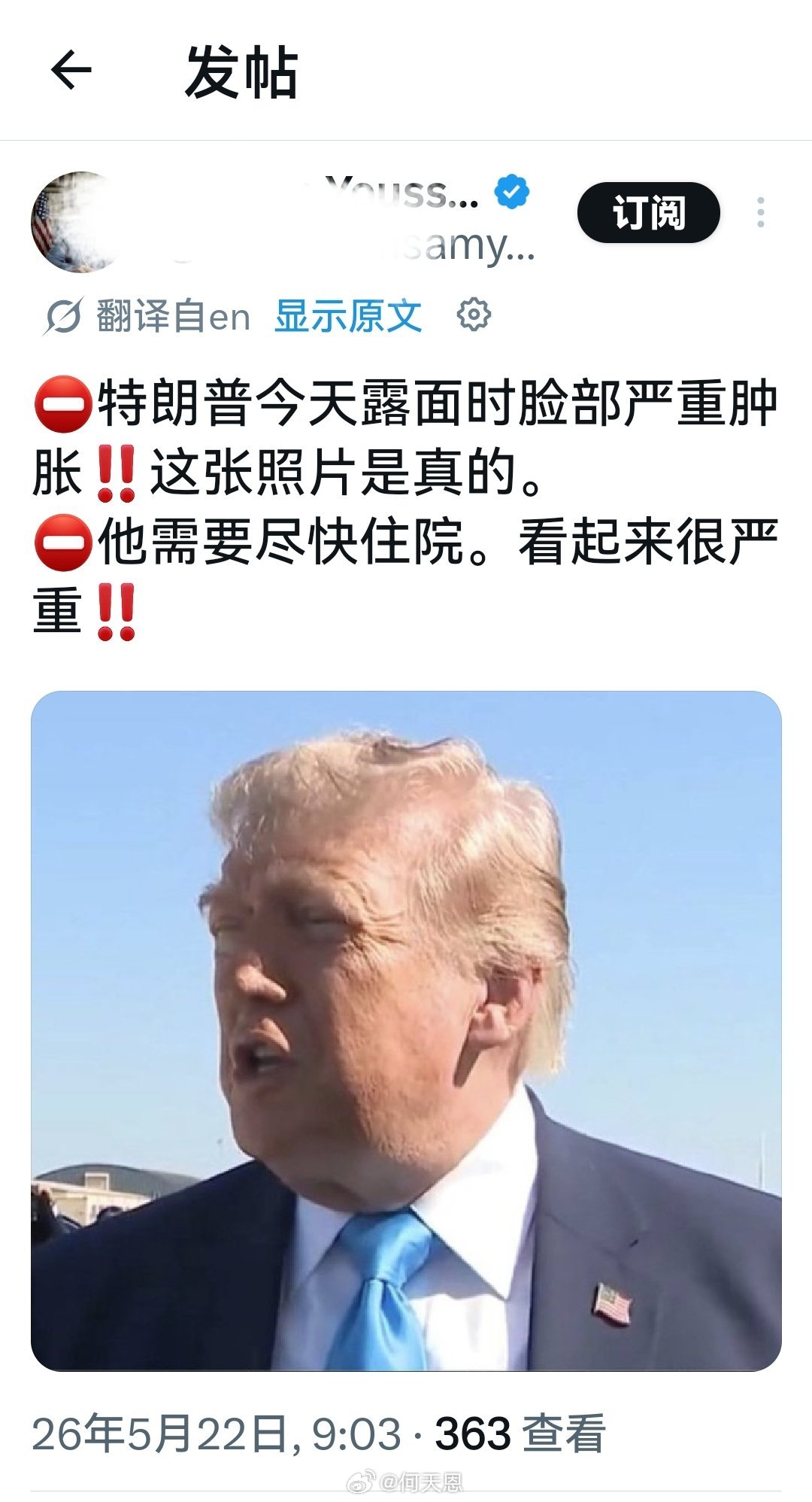 之前好像就发生过“歪嘴”现象。跟谎言说太多是不是也有关系？海外新鲜事何天恩