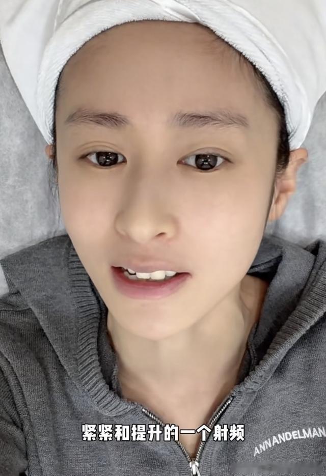 敷麻药还疼哭，37岁颖儿做眼部热玛吉，普通人真要跟风吗？ ​​​
