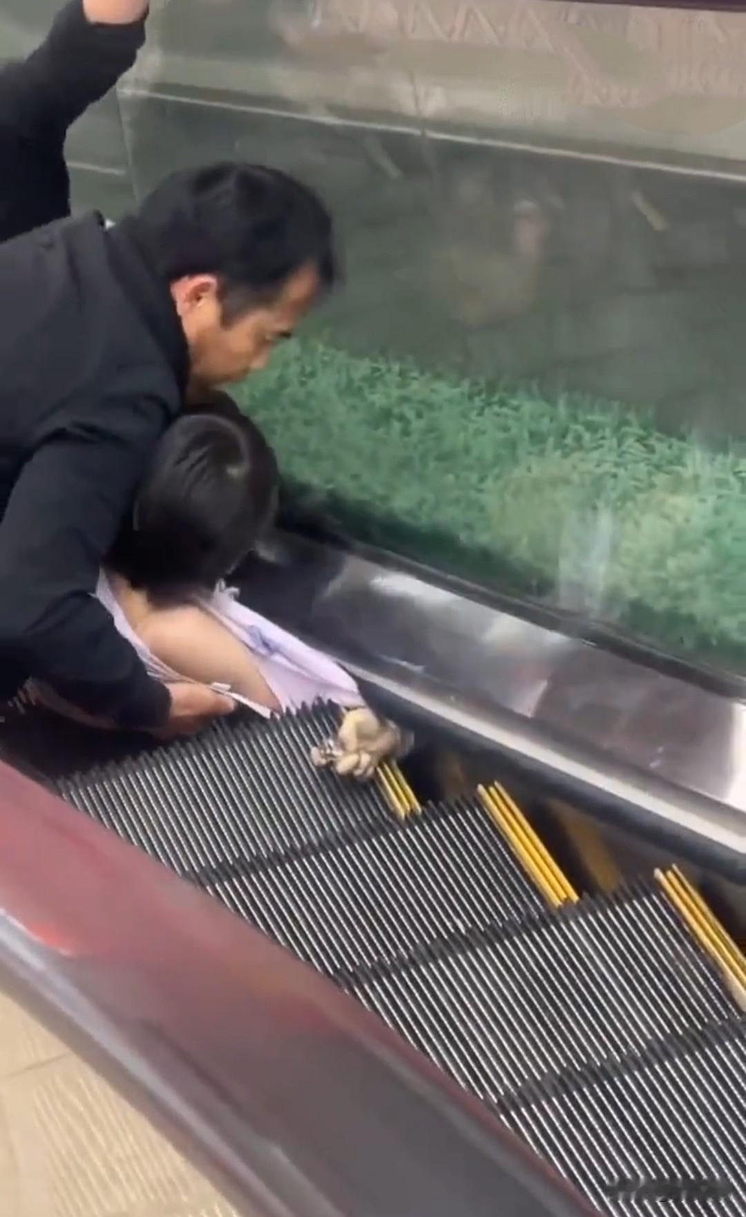 太惨了，孩子乘坐商场自动扶梯，手被电梯夹住。
看那只已经变乌，没有一点血色的手掌