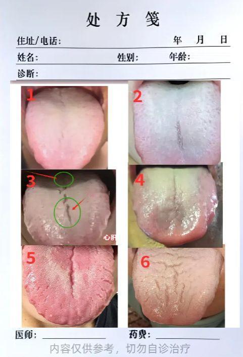 想知道那方面行不行，伸出舌头就知道！

我分享六种那方面不及格的舌象，看看你是否