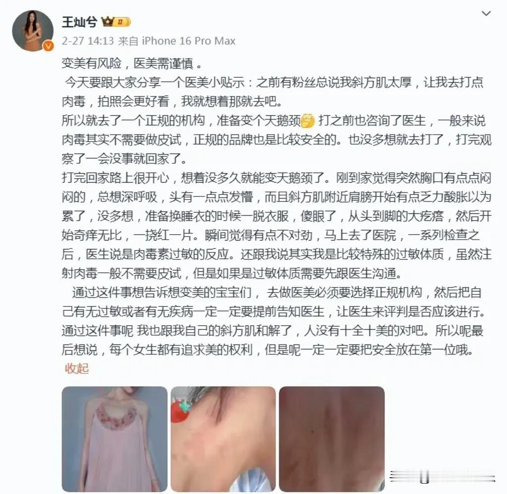 杜淳爱妻王灿医美之旅突遇波折：肉毒杆菌注射引发全身过敏惊魂记

在娱乐圈的光鲜背