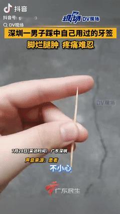 “悲剧还是发生了！”广东一男子不小心踩中了，自己用过的牙签，眼看伤口就一个小洞，
