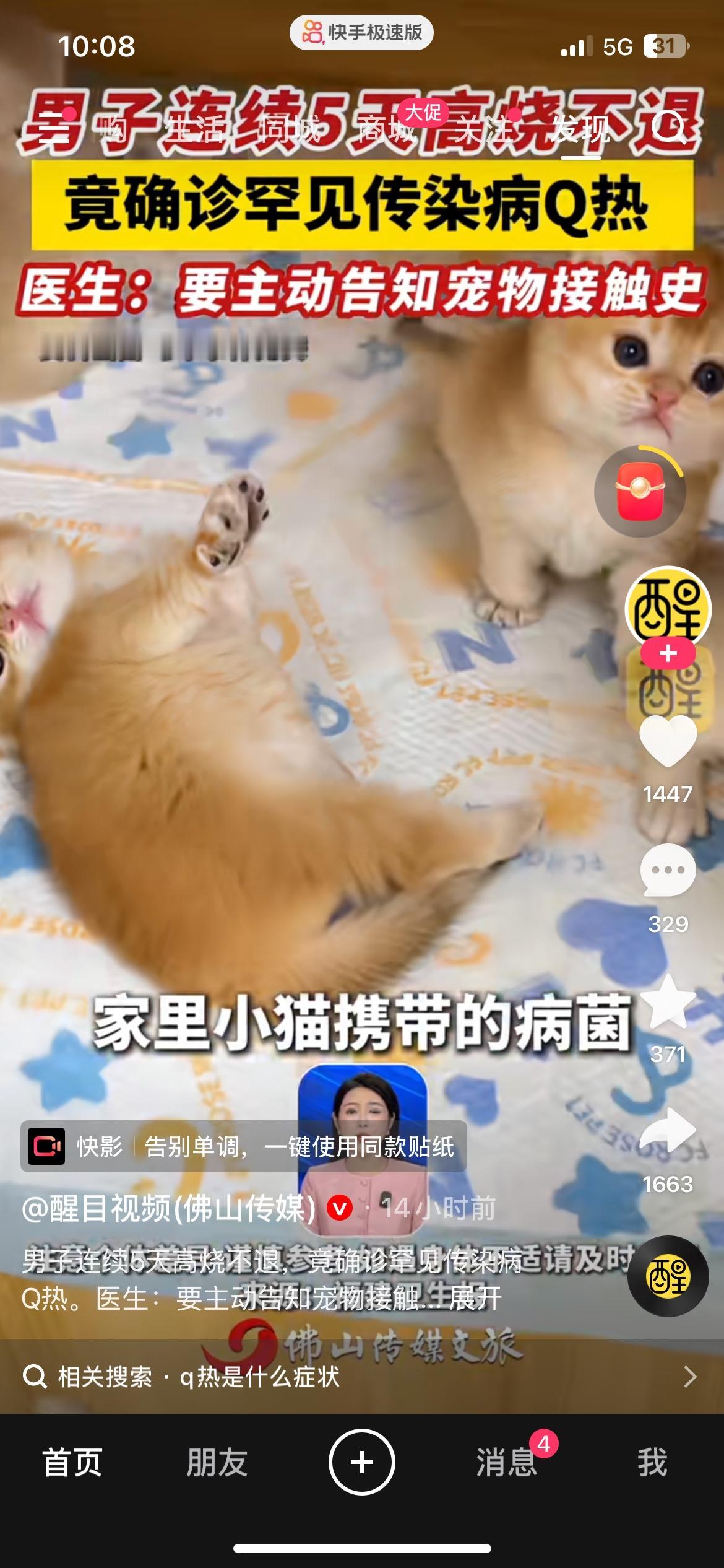 男子高烧五天不退，查出罕见Q热
谁能想到，持续发烧查不出原因，竟然是这种少见的病
