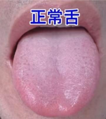 今日不忙，给大家公益看舌象，挑战年前分析555个舌象，你发我分析，结果马上出！！