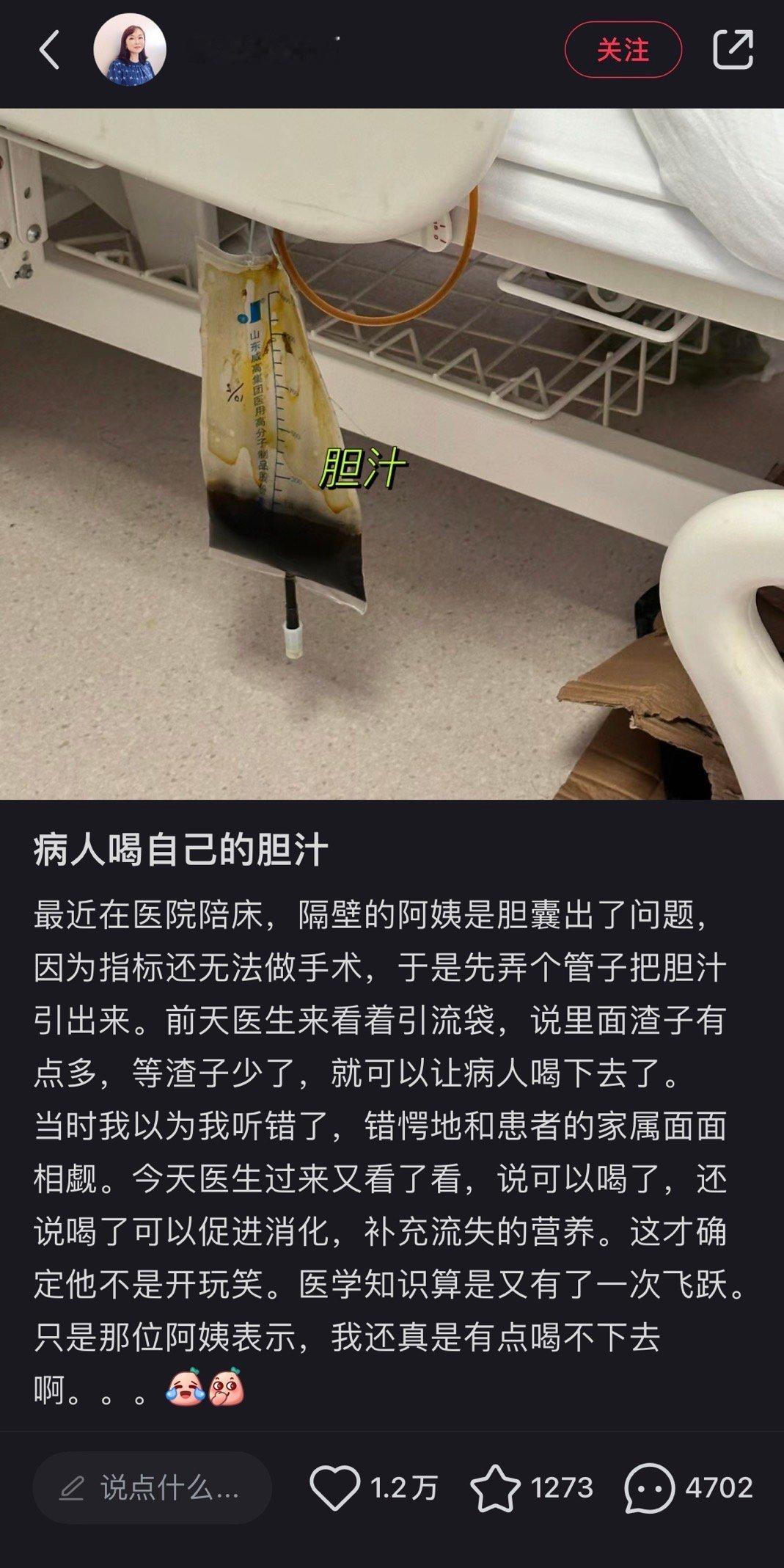 原来引出来的胆汁还可以再喝下去用于治疗[哆啦A梦害怕] ​​​