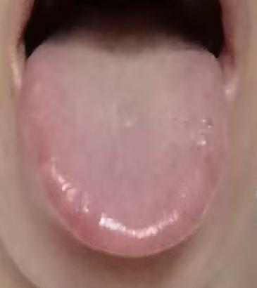 中年身心状态不佳，每到凌晨固定早醒，根源多和肝气不畅有关







近期有位