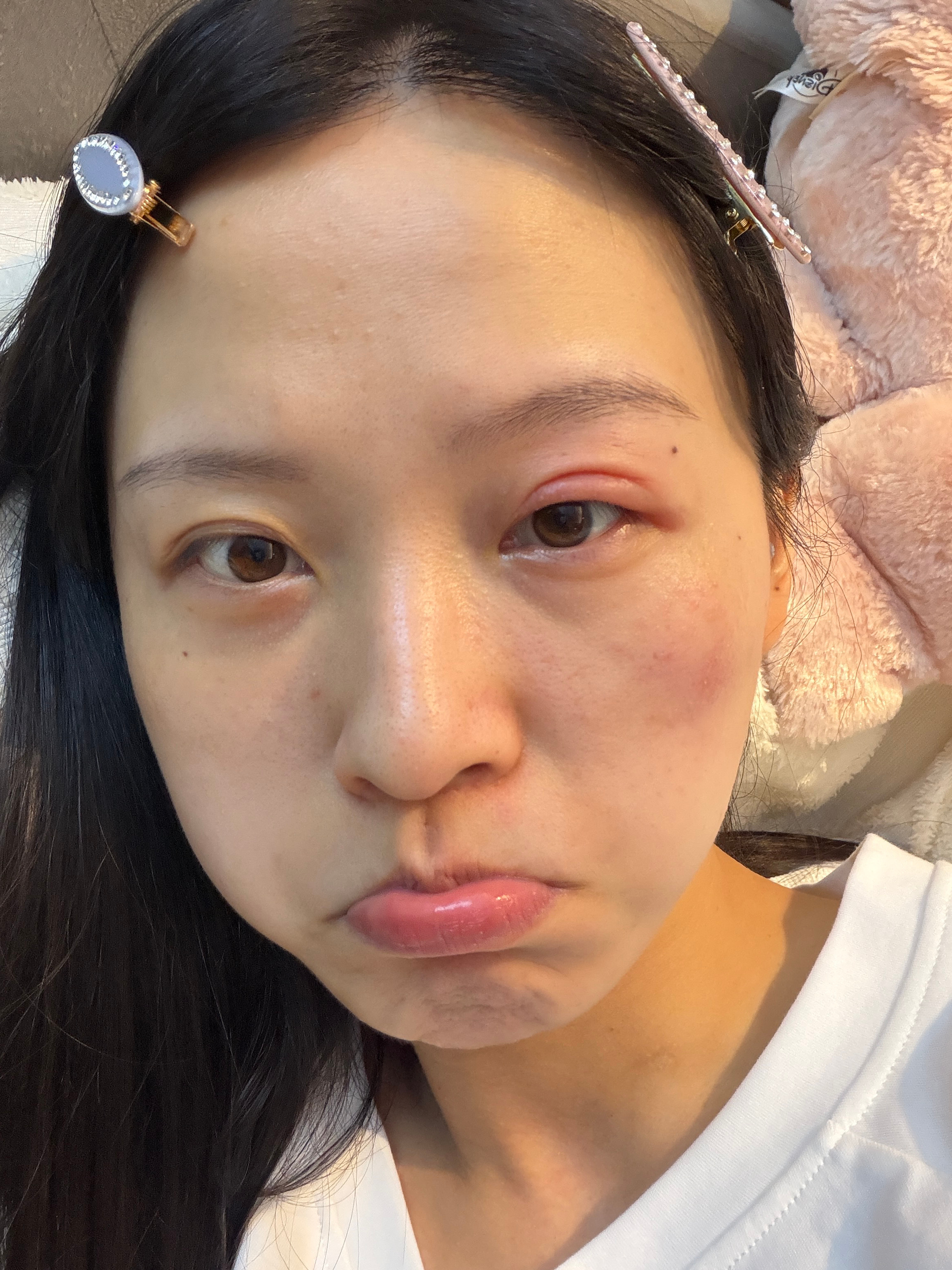 为什么总爱咬我的右睛！！！ ​​​