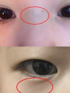 这些年接诊的矮小、长得慢的孩子，大多数都有以下问题，家长注意查看
 
1、睡眠不
