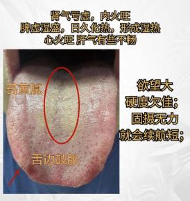 两个火旺的舌头分享，看看你有没有这种情况？



