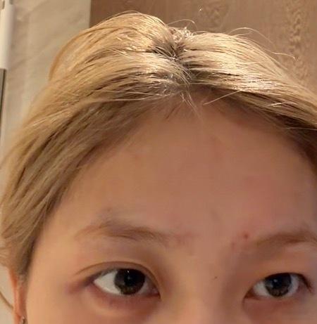 我双眼皮呢？ ​​​