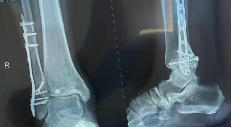 蠢得像猪，本来你看热闹就行了，非要显摆自己，
这下崩了你就高兴了！

有些人的悲