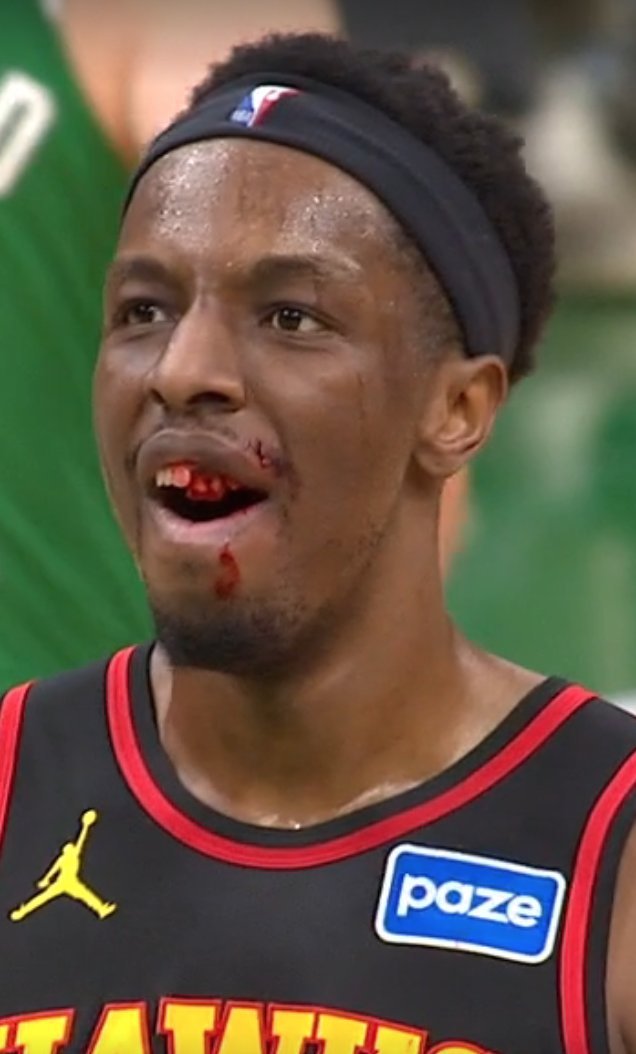 奥孔武的两颗牙！老鹰vs凯尔特人