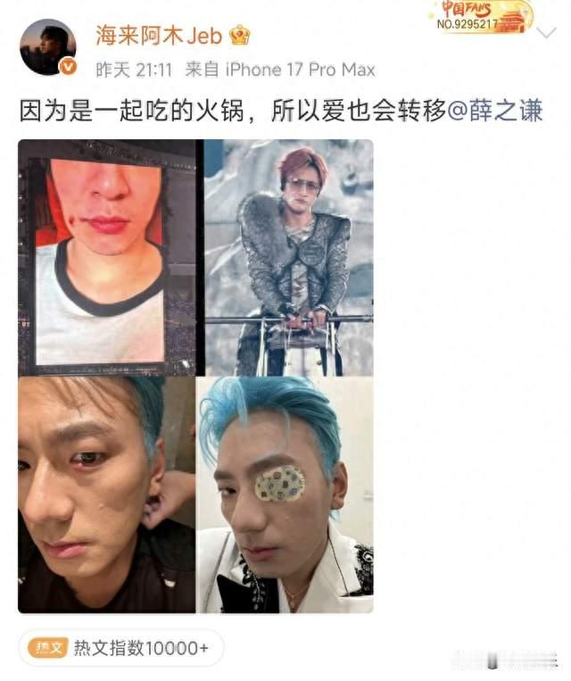 海来阿木与薛之谦聚餐，薛之谦意外中招！