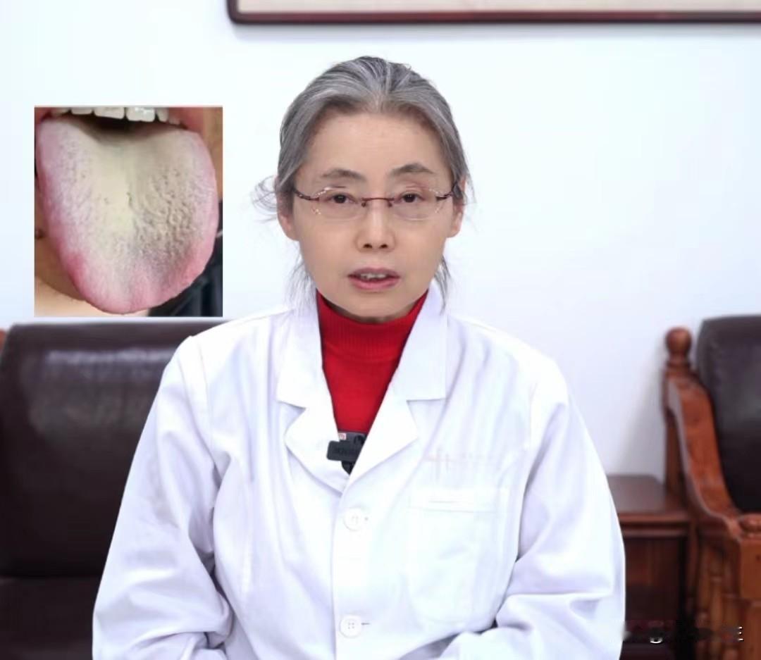 湿气重不调理，等到化热后就有你哭的了！ 

这位患者一开始就说自己胃口不好，消化