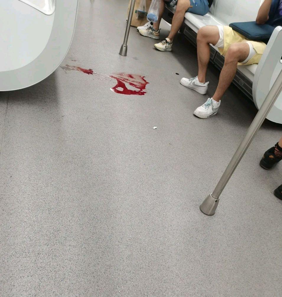 在地铁上，女孩因为生病没忍住一口血吐在地上。可她的第一反应不是喊人求助，而是担心