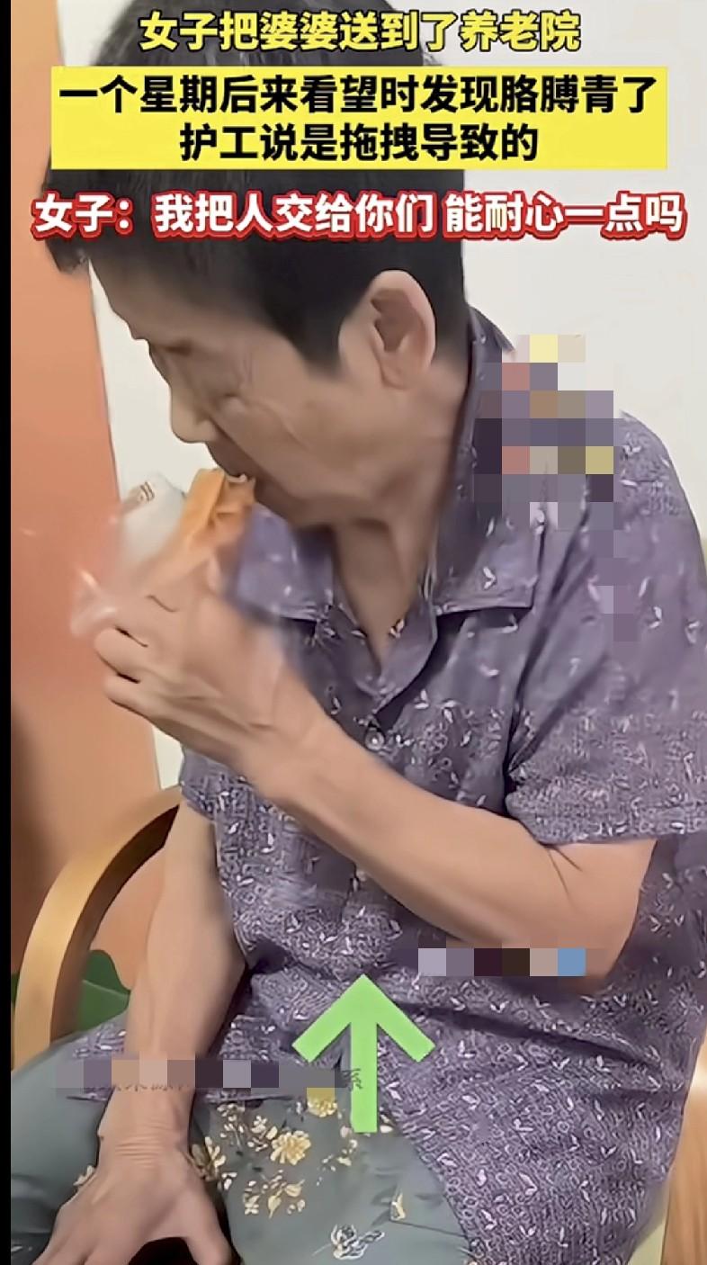 婆婆胳膊青了！

护工一句“拖拽”女子当场炸裂

这托底变砸底？

监控死角+人