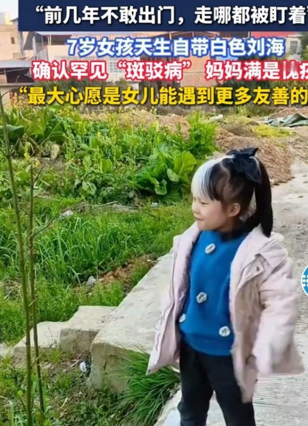 湖南邵阳的7岁女孩乐乐，有一头乌黑的头发，却自带白色刘海，像个精致的混血洋娃娃，
