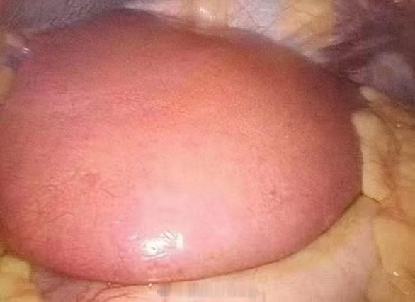 #面色发黄或是肝不好的表现#此黄非彼黄。肝不好引起的黄，有如下特征：1、眼白发黄