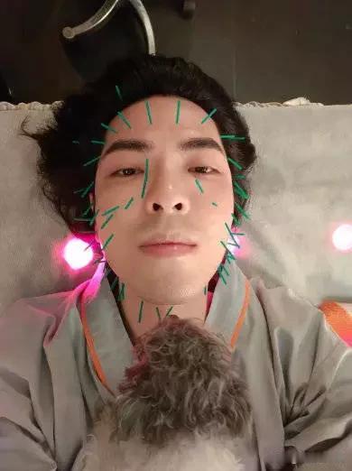 2月11日萧敬腾在社交平台秀出陪老婆林有慧做针灸的自拍照。

照片里，他脸上扎着