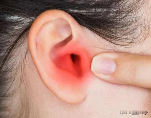 总觉得「耳朵痒」却掏不出东西，到底是哪里出了问题？

在日常生活中，很多人都有过