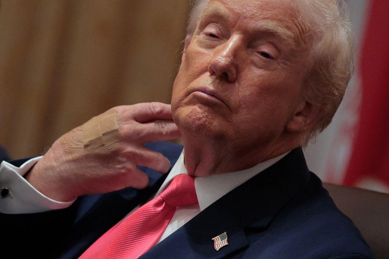 越来越多的华盛顿精英开始意识到，白宫正试图掩盖特朗普日益明显的健康问题。过去数月