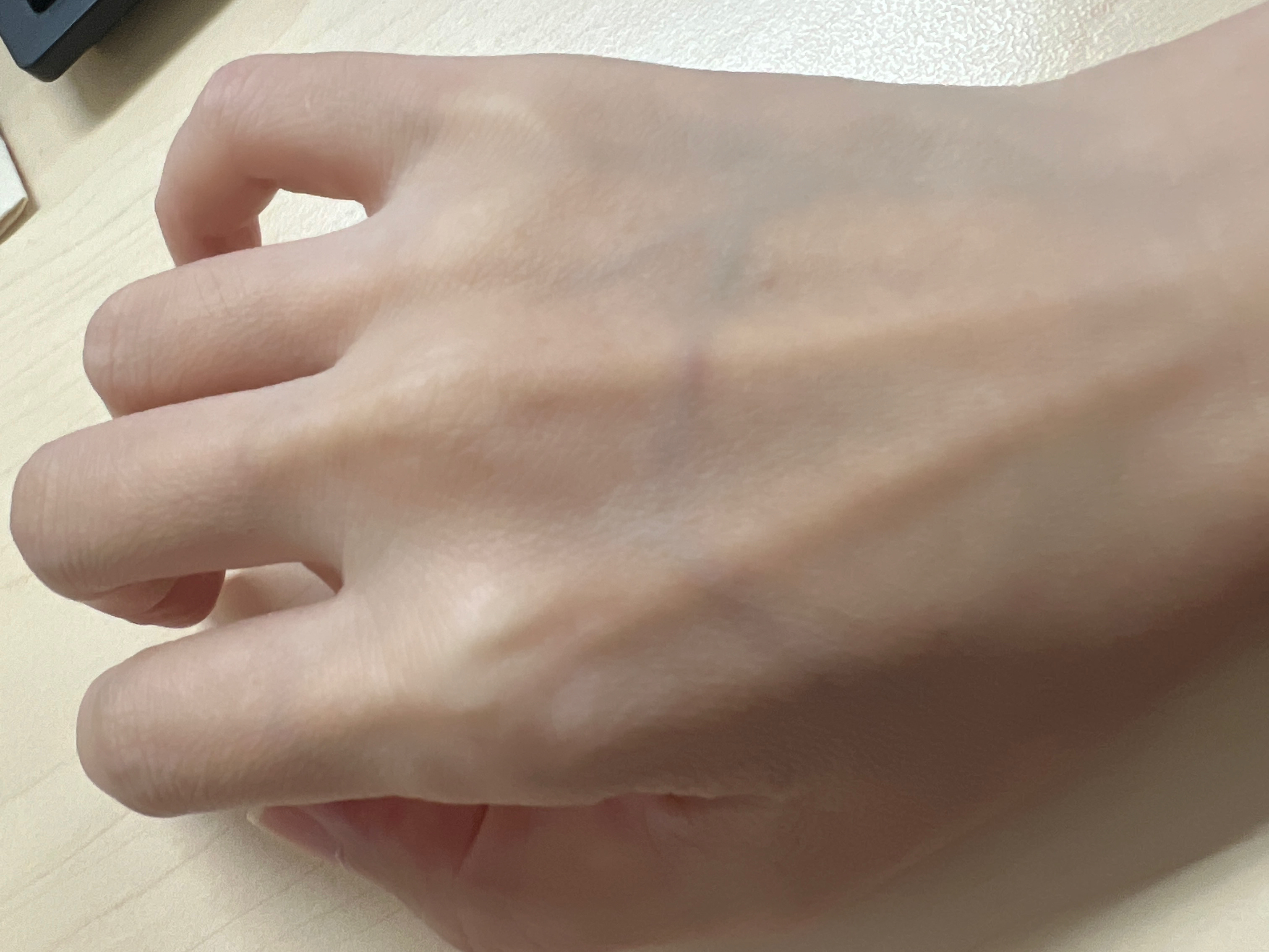 忽然发现自己好像又瘦了，这么像爪子呢…… 