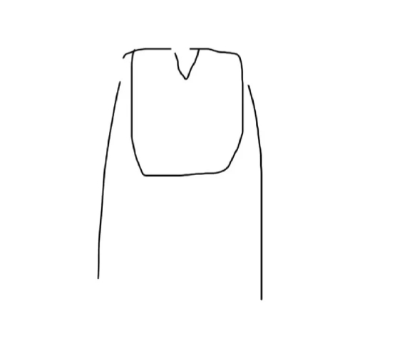 甲沟炎 剪v字 甲沟炎剪V字真的有用吗？感觉指甲这么剪会天天勾袜子 ​​​