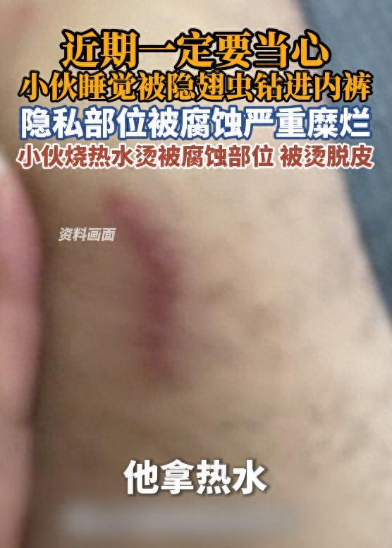 “太吓人了！”浙江台州，年轻小伙开窗睡觉，一只小飞虫钻进了他的被窝，他一个翻身，