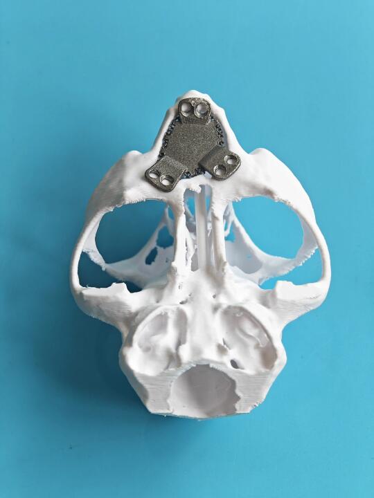 3D打印拯救上颚缺损小猫