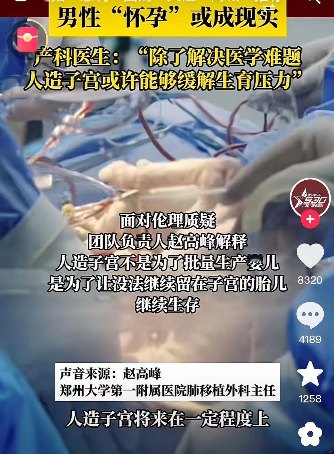 世界首例去ECMO人造子宫成功：男人怀孕成为可能。郑州大学第一附属医院完成了第四