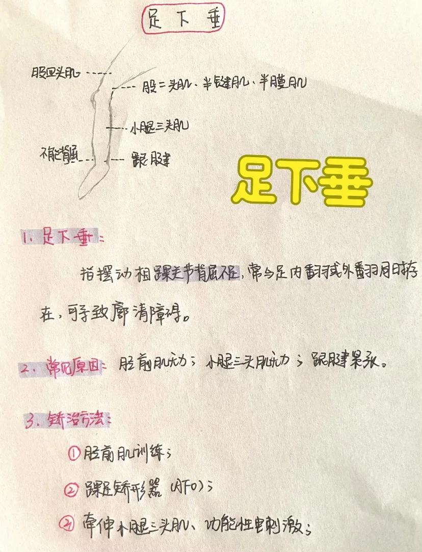 今日分享——足下垂