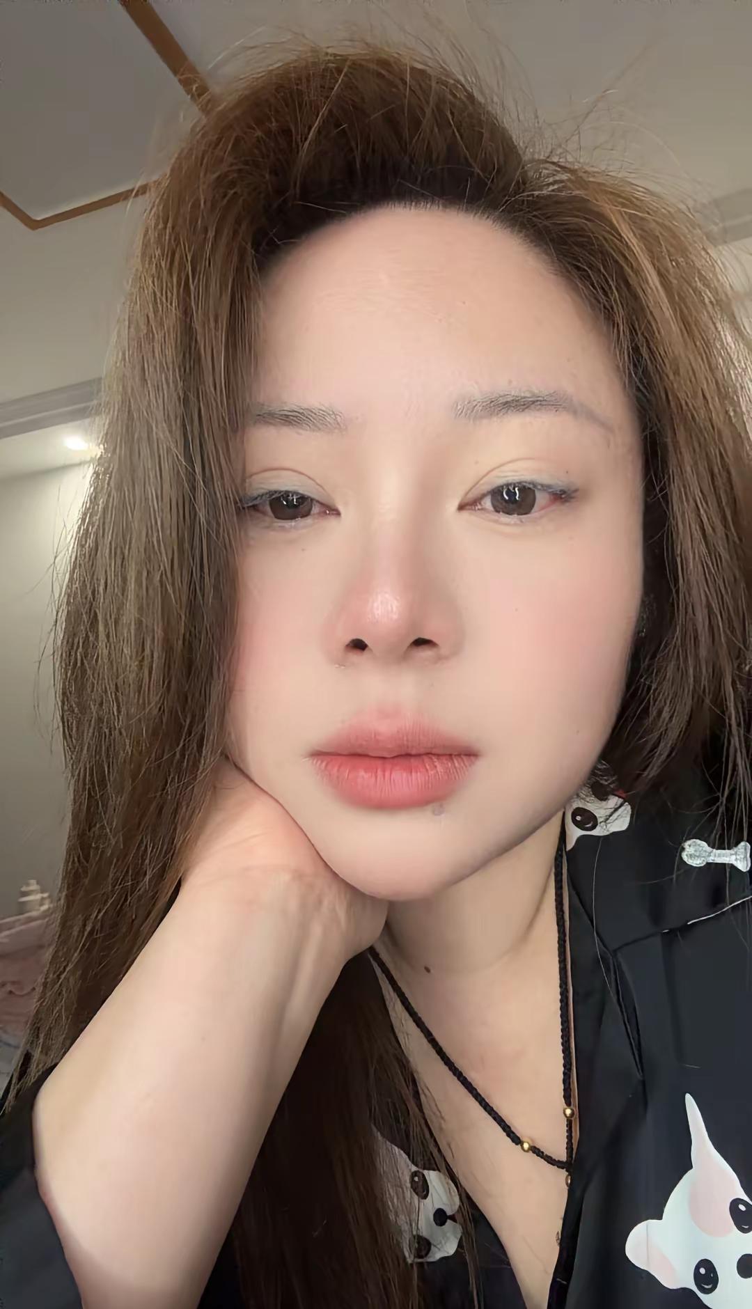 昨晚我好像就在死亡边缘走了一圈 开始激烈的头疼接着头晕厉害 天旋地转 就像人被扔