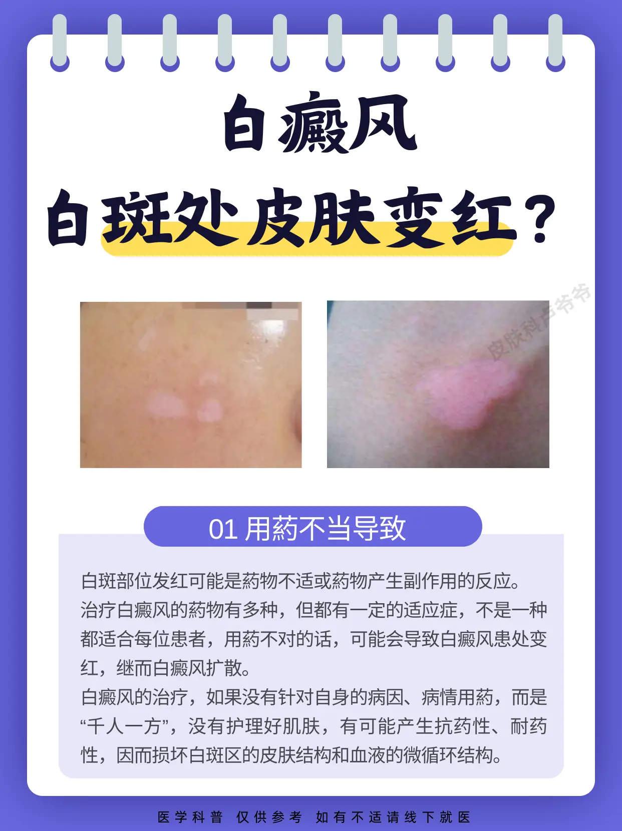 医学科普 白癜风 白癜风科普 硬核健康科普行动  白斑