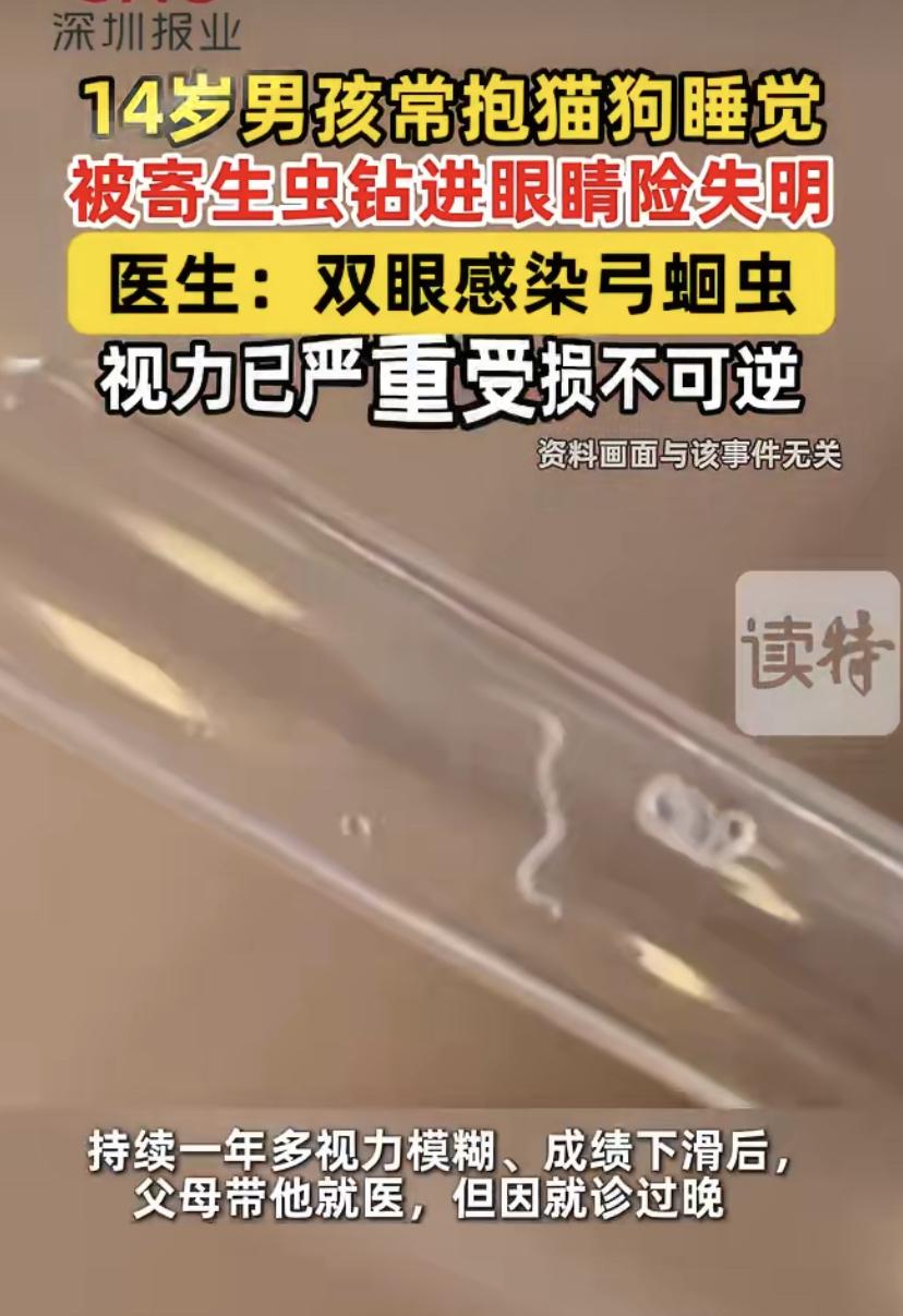 14岁男孩和猫狗同睡，双眼几乎失明!医生痛心：太晚了
湖北荆门14岁男孩小宇，平