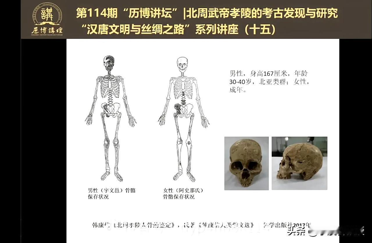 北周武帝身高167，他及他的突厥皇后的骨骼情况。图片来自“残兵弗雷德里希”。 ​