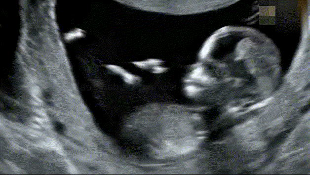 宝宝每天在妈妈的肚子里做什么[思考]？[期待]做得最多的：睡觉胎儿在妈妈肚子里都