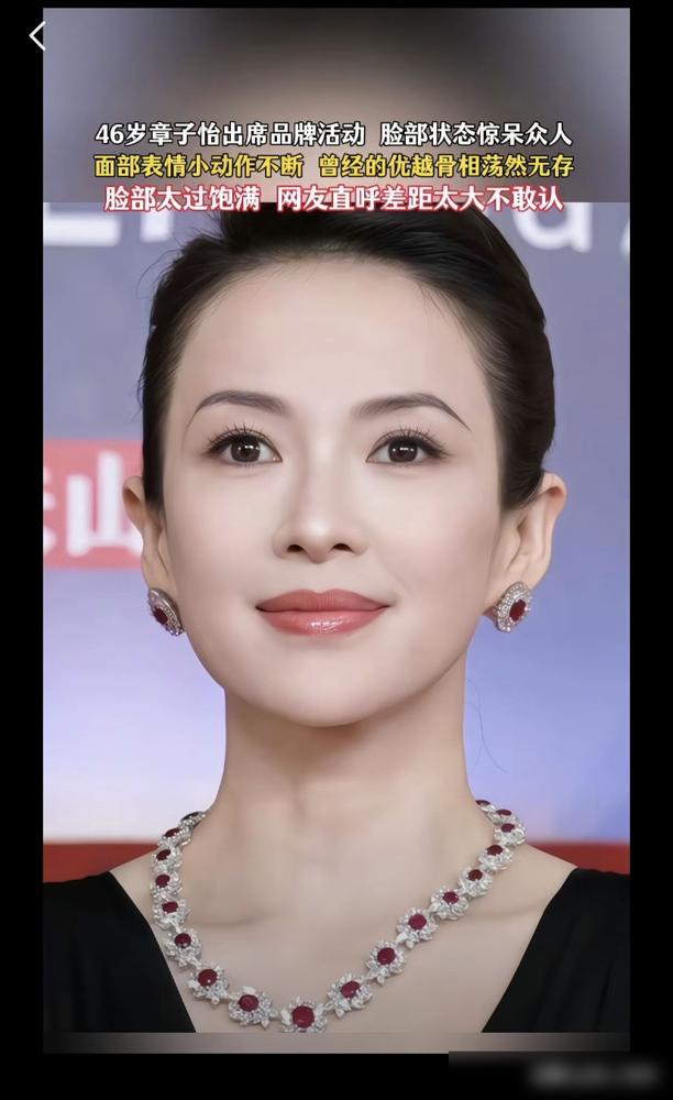 章子怡的脸怎么肿成这样了？苹果肌绷得像馒头，难道是医美翻车？
 
3月14日，她