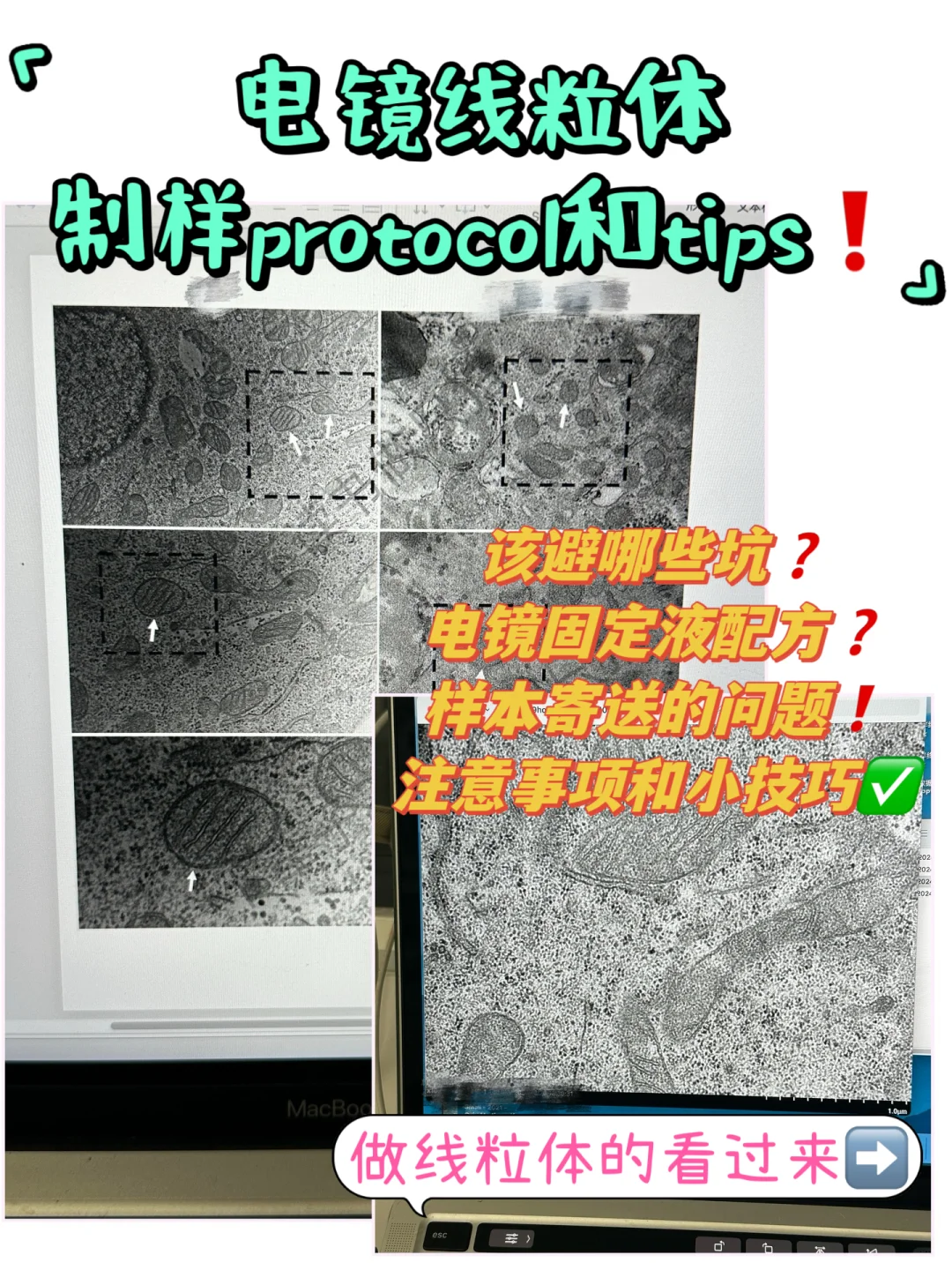 【电镜线粒体】制样protocol和tips🔬‼️