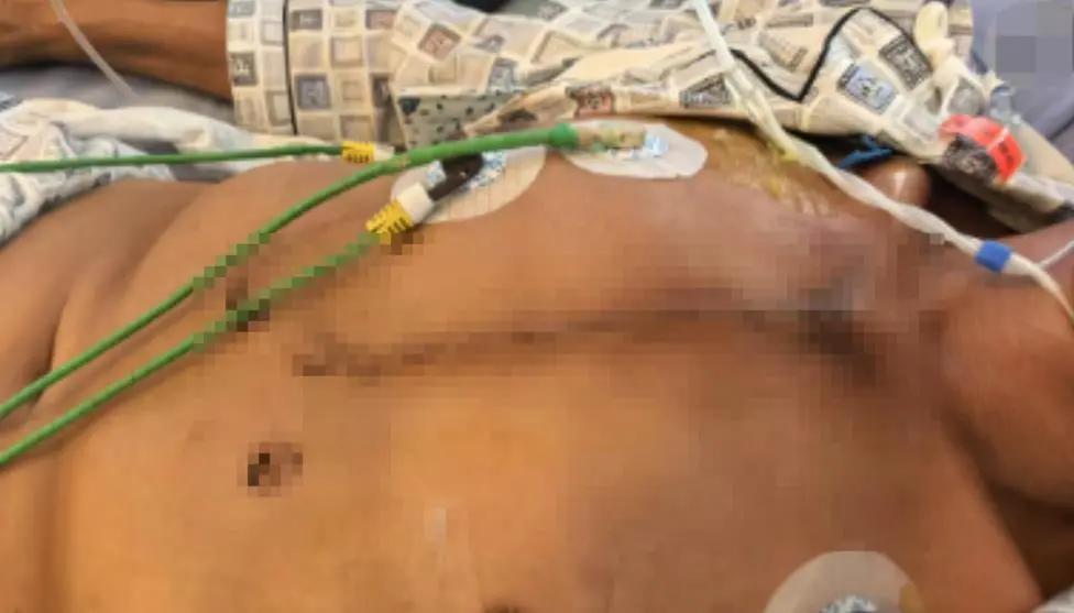 无视禁令酿祸端，不藏了！
12月12日，四川泸县有关部门通报，10月10日男子黄