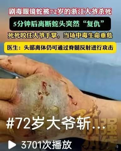 浙江一名72岁大爷捕杀一条剧毒眼镜蛇，将蛇身斩断，自以为危险彻底解除。谁能想到时