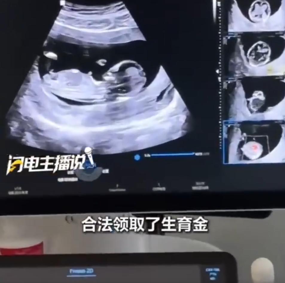 “聪明过头了！”9月13日报道，一女子刷到“流产后可申领生育保险基金”的信息，她
