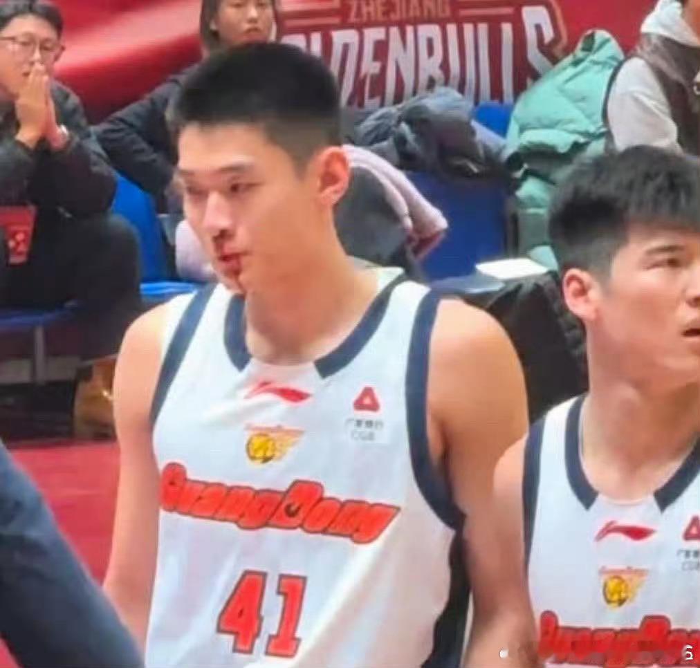 今天杜指导因为王洪泽被打出血吃t了吗？ 