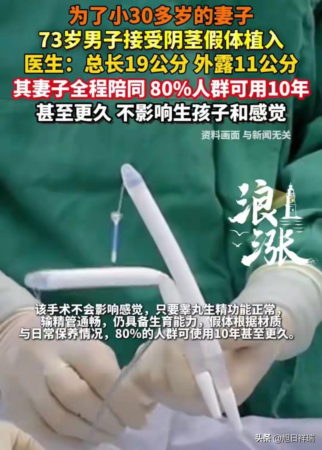 73岁大爷为小30岁妻子植入19公分阴茎假体，医生称：不影响生孩子和感觉。

我