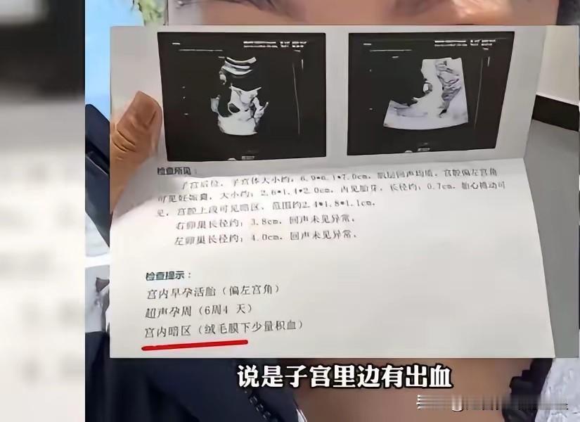 电热毯会伤到孕妇肚子里的宝宝？这事真得警惕！

北京一位准妈妈因为天冷铺了电热毯