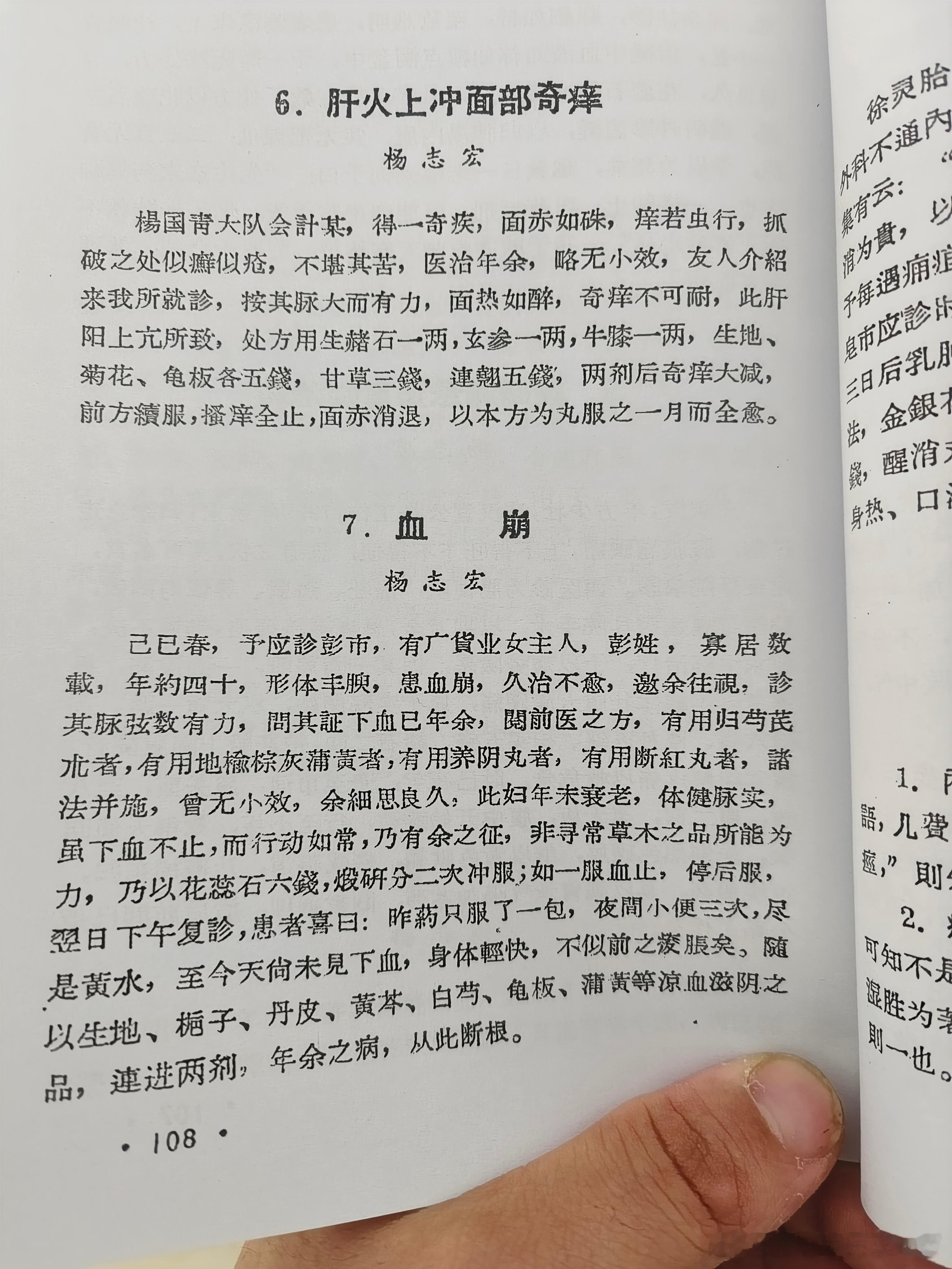 花蕊石治疗妇人血崩证#典籍里的中医#  ​​​