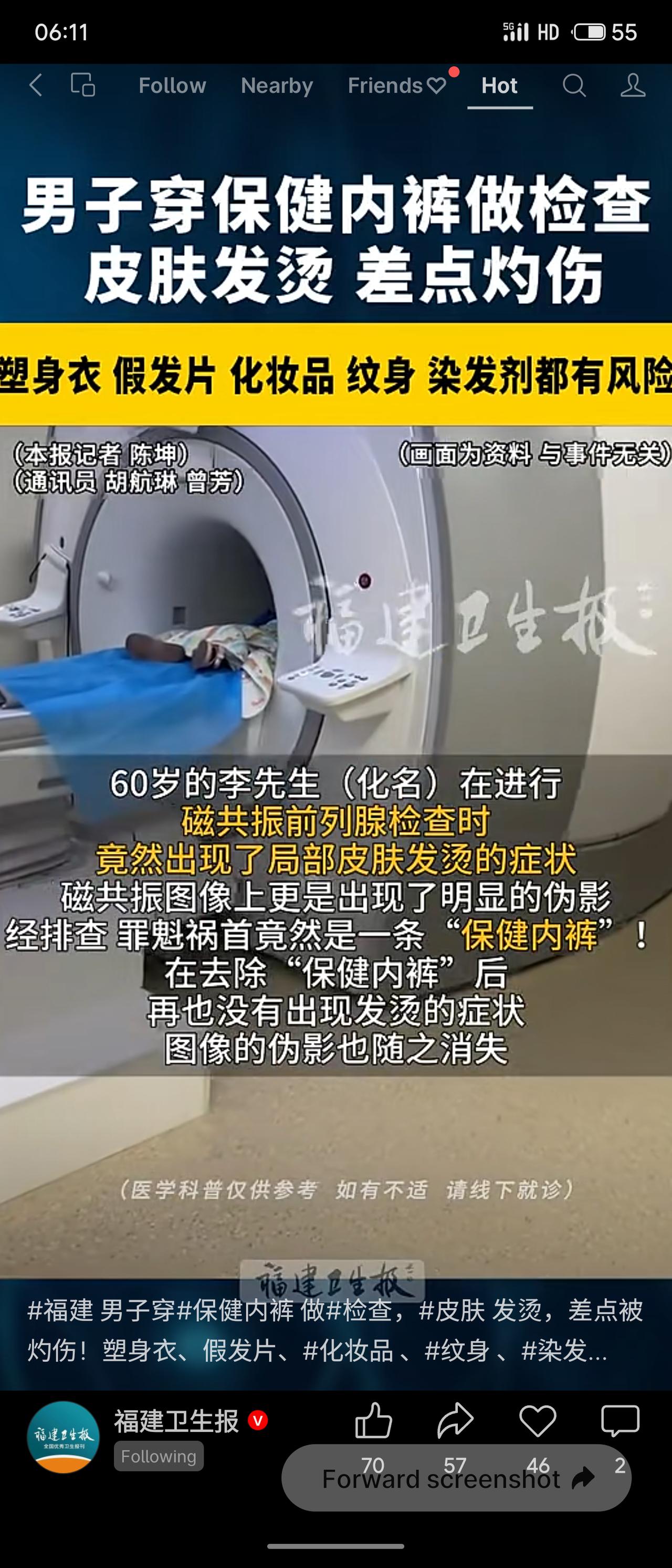 福建六旬男子穿含金属纤维的“保健内裤”做磁共振，致皮肤发烫、图像伪影，脱除后恢复