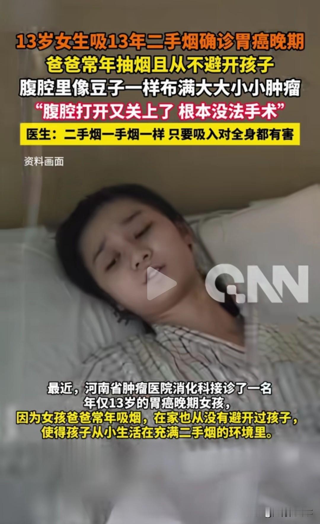心痛！13岁女孩胃癌晚期，腹腔布满肿瘤！只因父亲这个习惯……

看到新闻，手都在