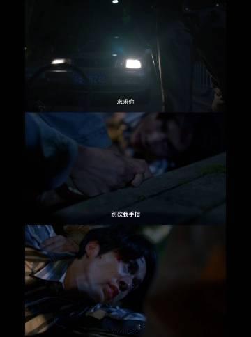 十指连心断指该多痛  那个年代的混乱秩序实在吓人，还好现在生活好多了，看柳钧的经