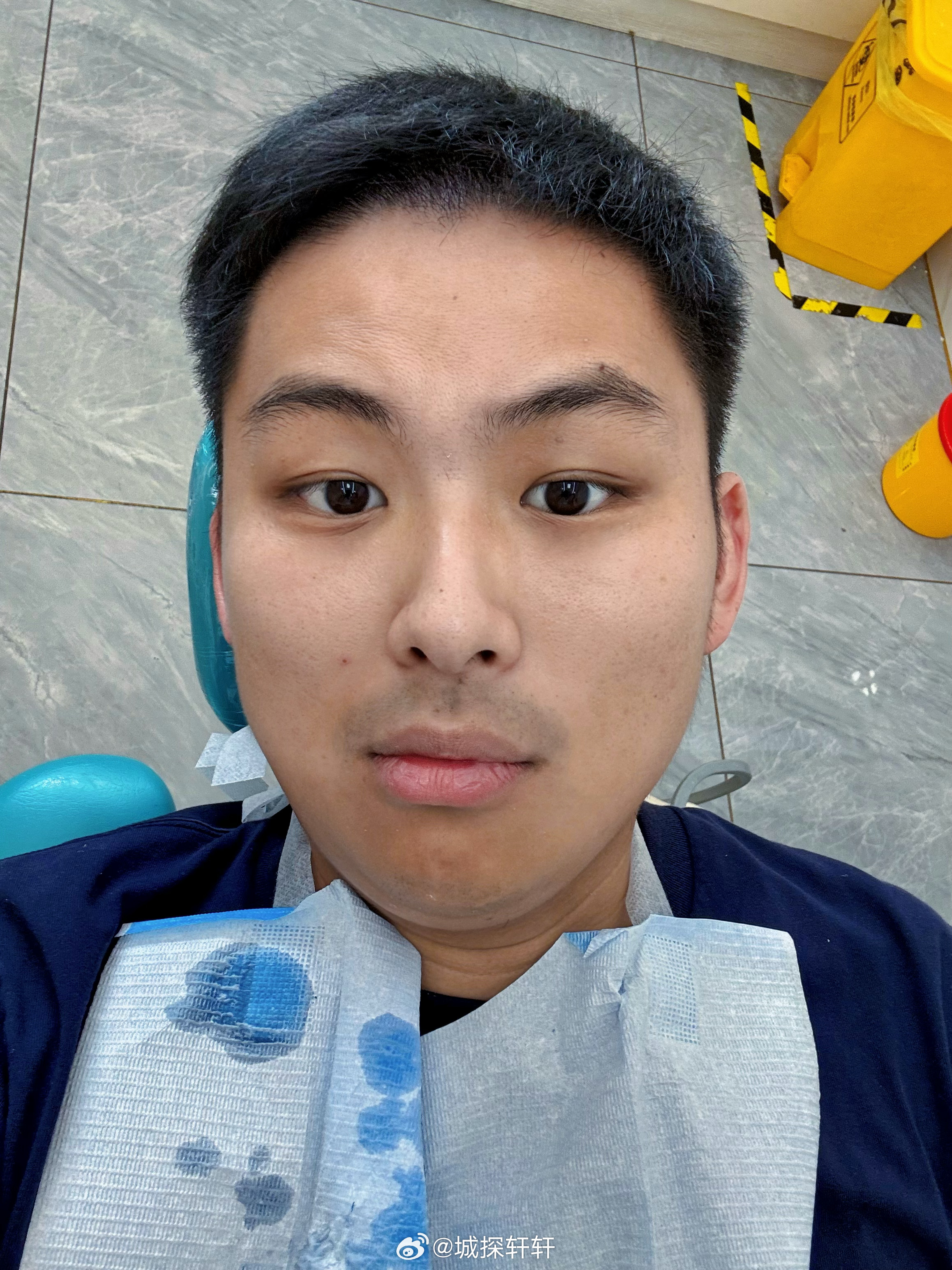 我的日常plog 我的天啊…… 杭州·杭州口腔医院